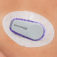 onduo dexcom